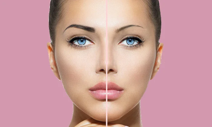 Portrait d'une femme avec le côté gauche de son visage maquillé en permanence et le côté droit sans maquillage.